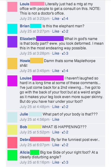 Man posts photo of a mysterious part of his body on Facebook, sending his friends into a spiral of confusion and horror.